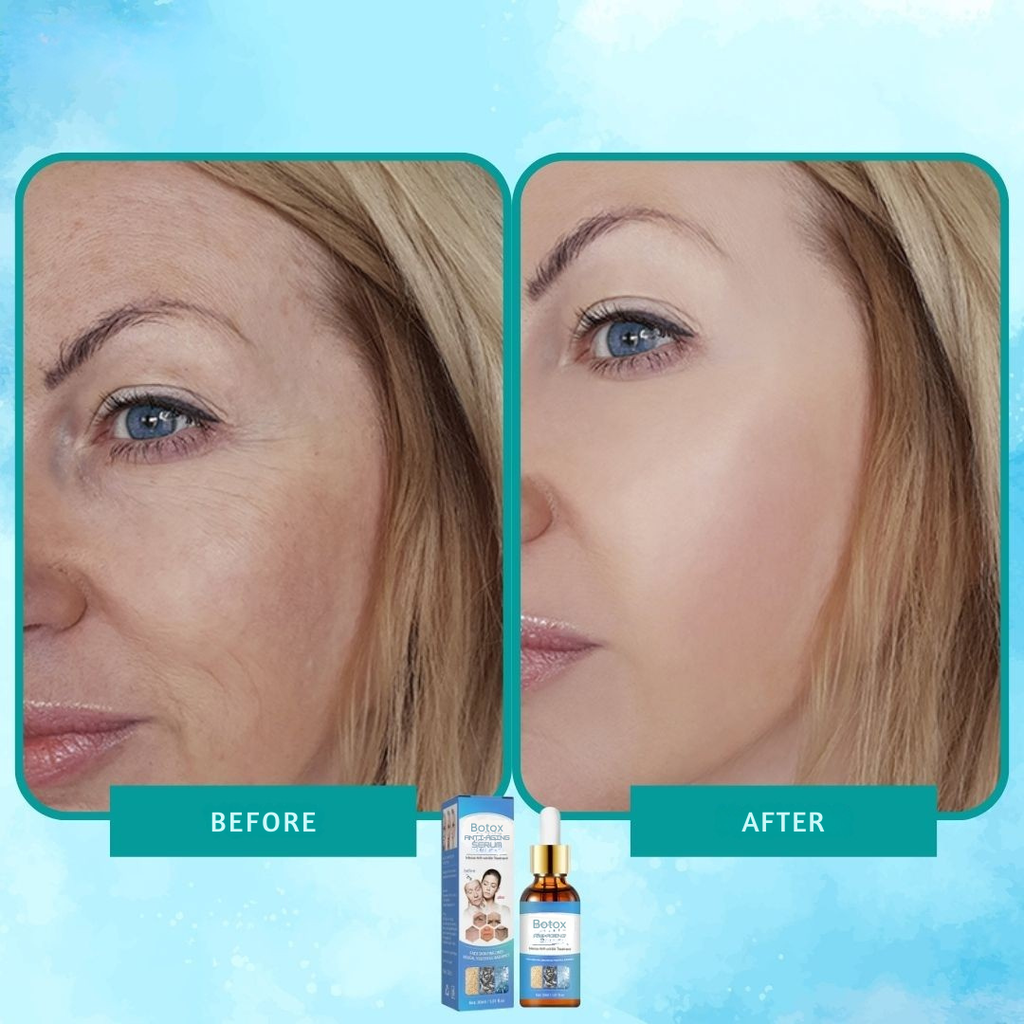 Botox-Serum intensives Anti-Falten-Elixier 