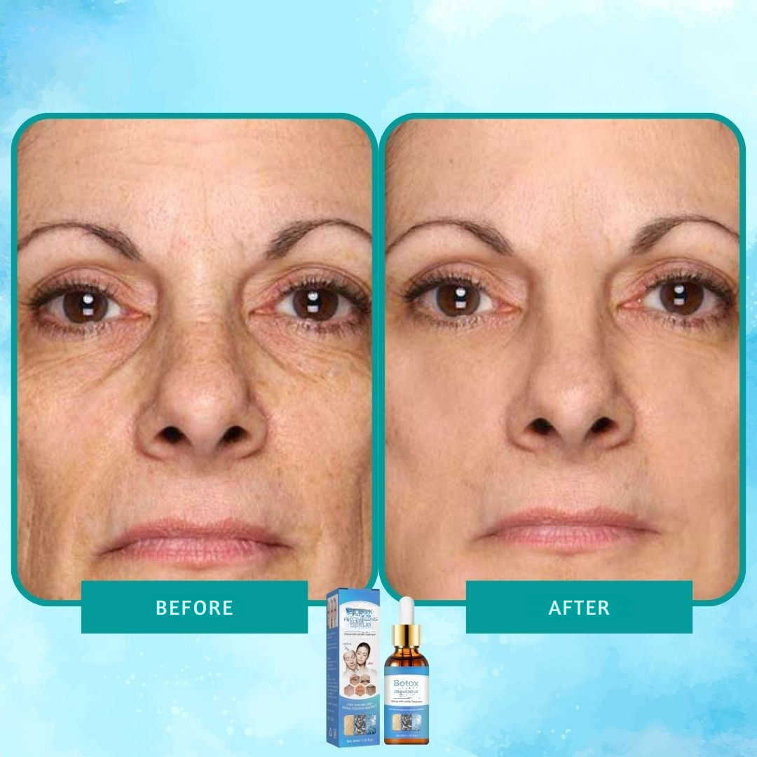 Ser botox elixir anti-riduri intens 